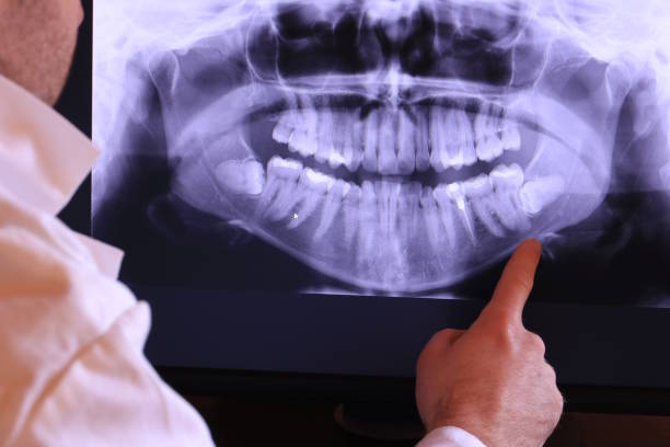 Best Emergency Broken Tooth Repair in Island Walk, FL