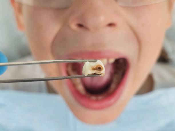 Best Emergency Dental Surgery in Island Walk, FL